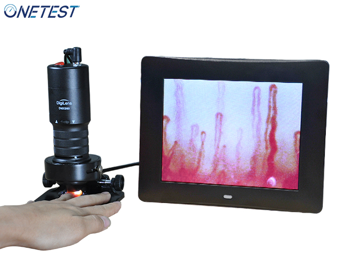 微循環(huán)血液檢測儀特點與應用是哪些 微循環(huán)血液檢測儀特點與應用是哪些